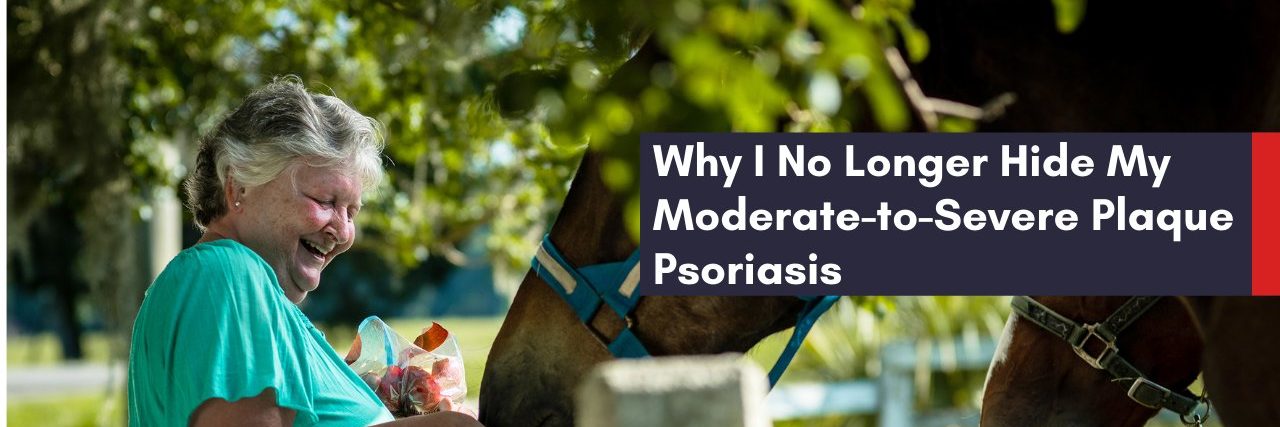 Why I No Longer Hide My Moderate-to-Severe Plaque Psoriasis