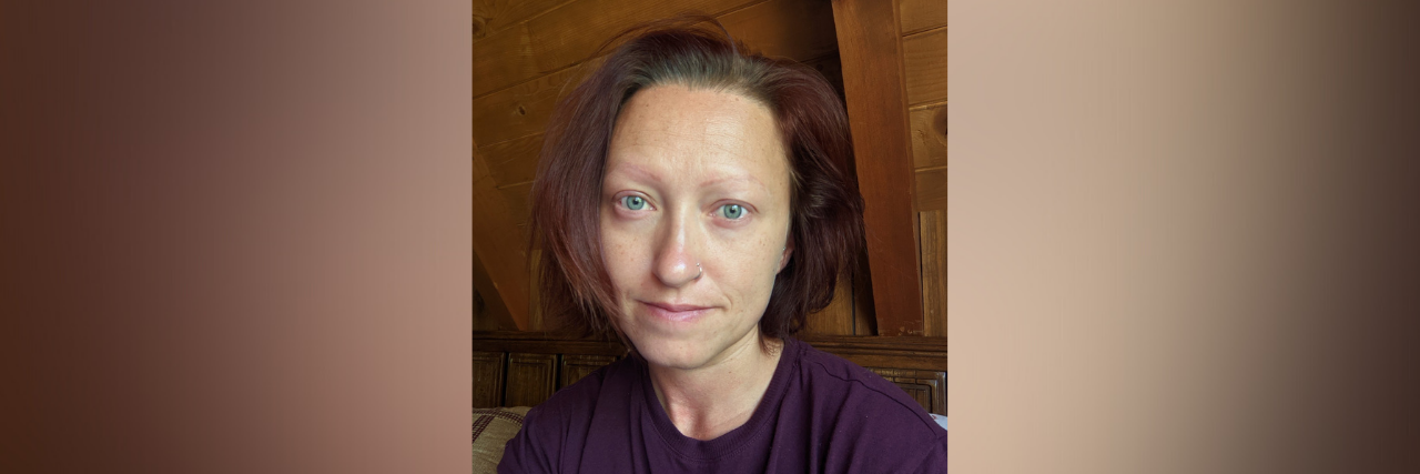 Why Trichotillomania Is so Hard to Understand and Explain