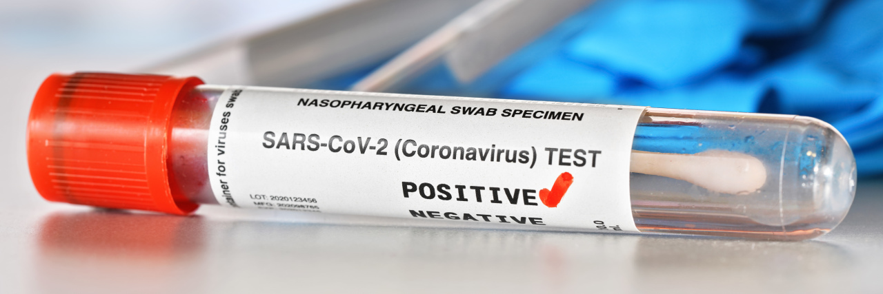 Getting Breakthrough COVID as a Vaccinated, Immunocompromised Person Coronavirus test tube showing positive test result.