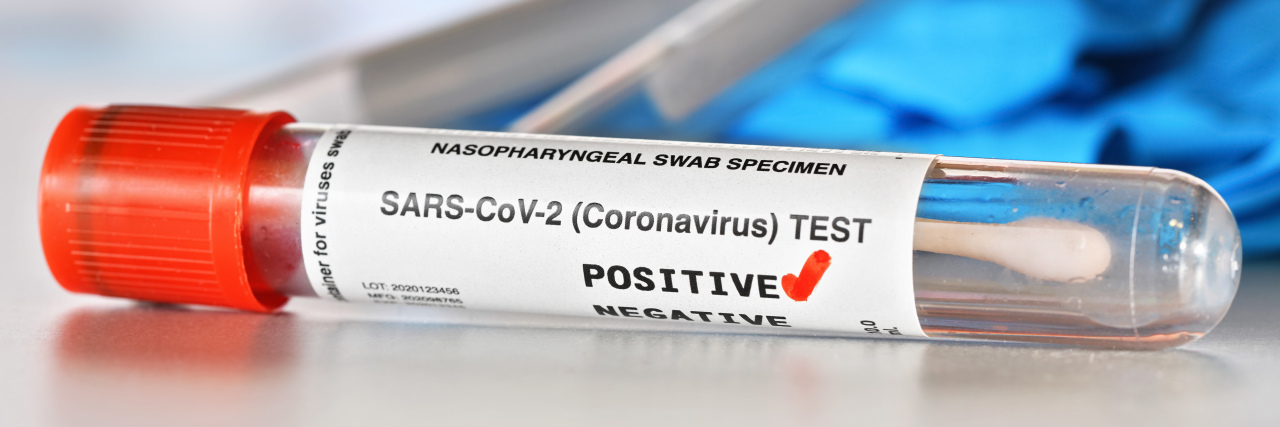 Coronavirus test tube showing positive test result.