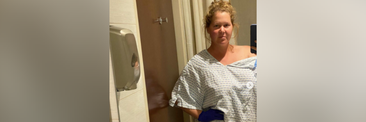 Comedian Amy Schumer Shares Endometriosis Excision Surgery Experience Amy Schumer in hospital gown after endometriosis surgery