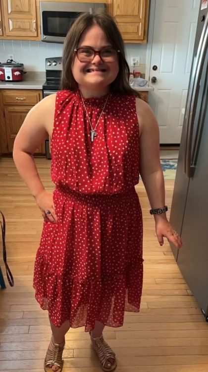 a young woman with Down syndrome wearing a red polka dot dress