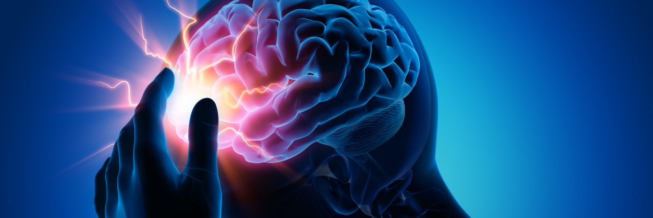 AskMe: We Asked an Expert All of Your Questions About Migraine Illustration of person's brain with migraine.