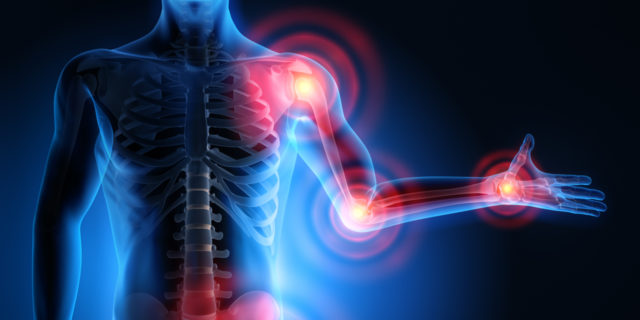 Gout 101: What Happens in Your Body During a Flare Diagram of how rheumatoid arthritis affects the joints.