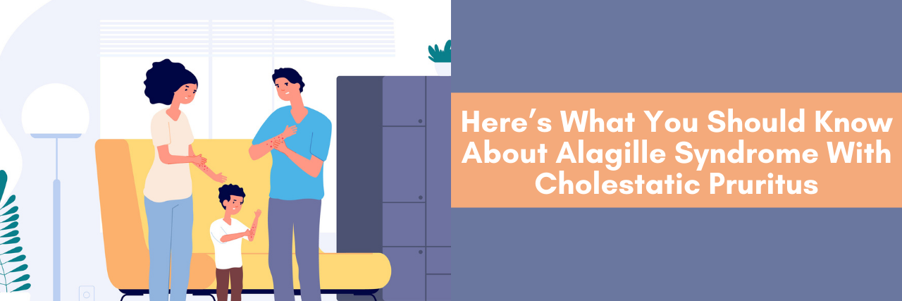 Here’s What You Should Know About Alagille Syndrome With Cholestatic P Here’s What You Should Know About Alagille Syndrome With Cholestatic Pruritus. Image of family scratching.
