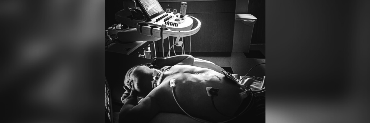 The Hard Moments as the Parent of a Child With Complex Needs Black and white photo of AJ in exam room, laying back calmly with sensors attached to a machine nearby