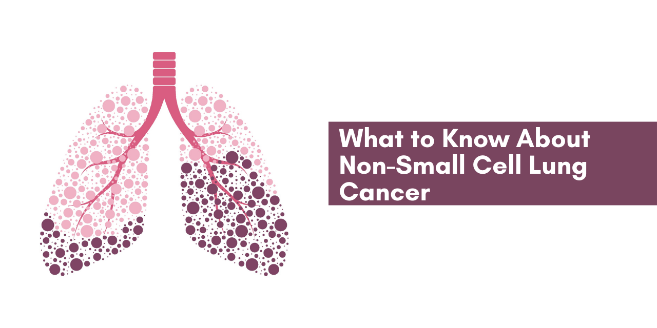 What to Know About Non-Small Cell Lung Cancer