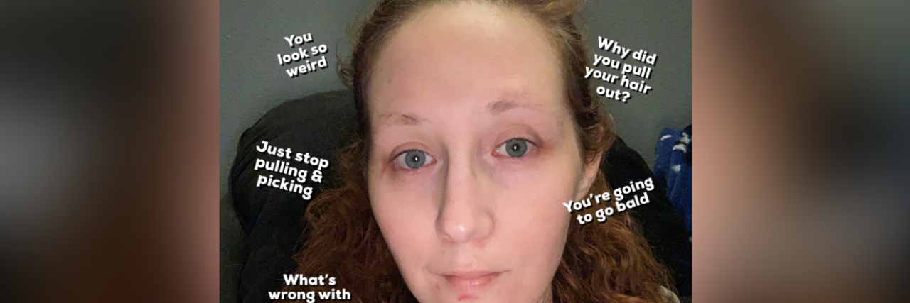 What Not to Say to Someone With Body-Focused Repetitive Behaviors Photo of contributor surrounded by comment examples from article