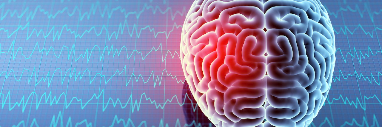 The Challenges of Traumatic Brain Injury Recovery Illustration of brain with one area lit up in red, surrounded by