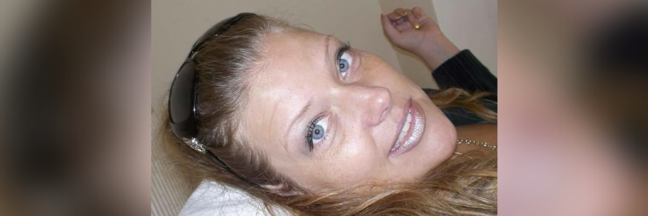 What the Hidden Pain of Trigeminal Neuralgia Is Like