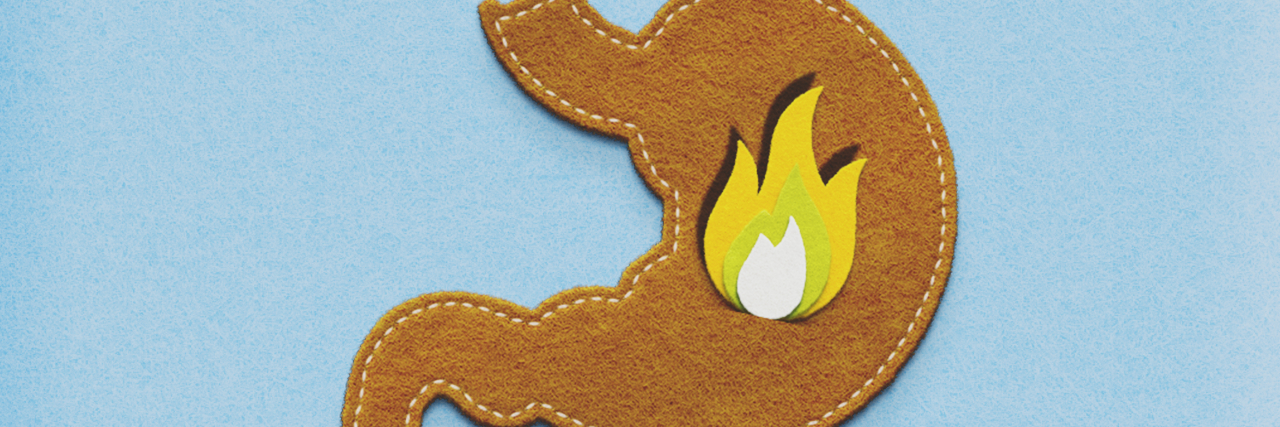 Learning to Advocate for Myself and Trust My Gut in Life With GERD Stitched fabric stomach with fire applique.