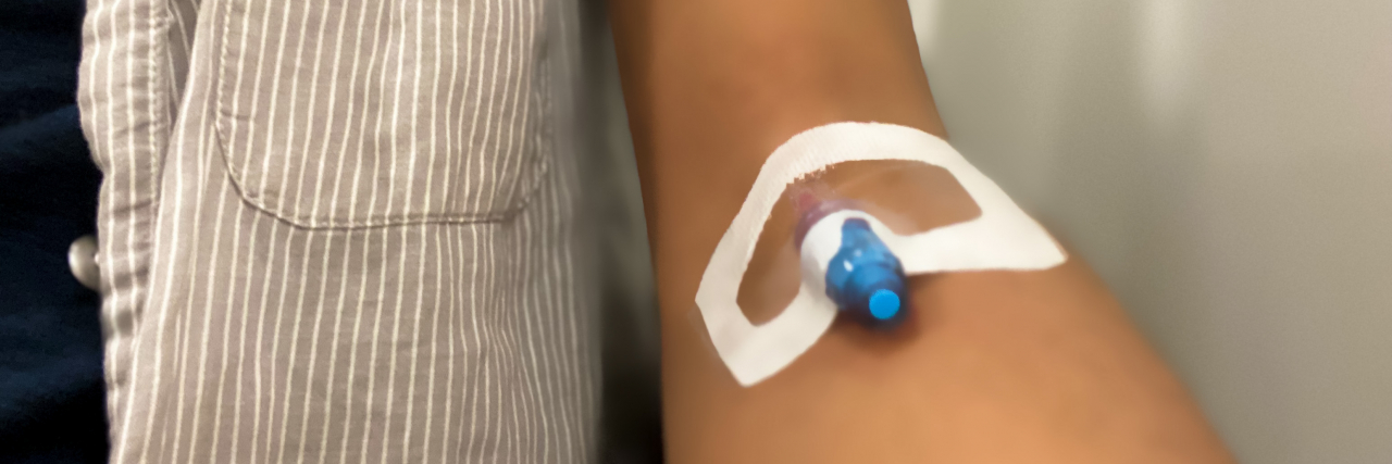 What It Was Like to Get My First Infusion Treatment for M.E. Woman's arm with IV port.