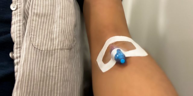 Woman's arm with IV port.