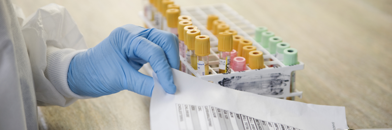 How the Pandemic Has Put My Chronic Illness in Diagnosis Limbo Lab technician with blood samples and medical chart.