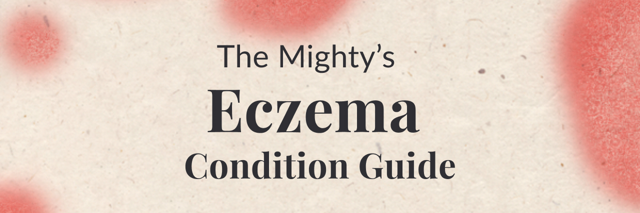 What is Eczema? An Information Guide to This Health Condition