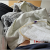 A glimpse of contributor's feeding tube and stomach, covered by blankets