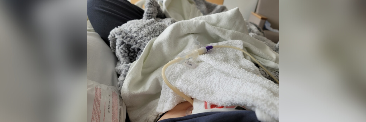 A glimpse of contributor's feeding tube and stomach, covered by blankets