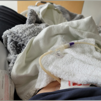 A glimpse of contributor's feeding tube and stomach, covered by blankets