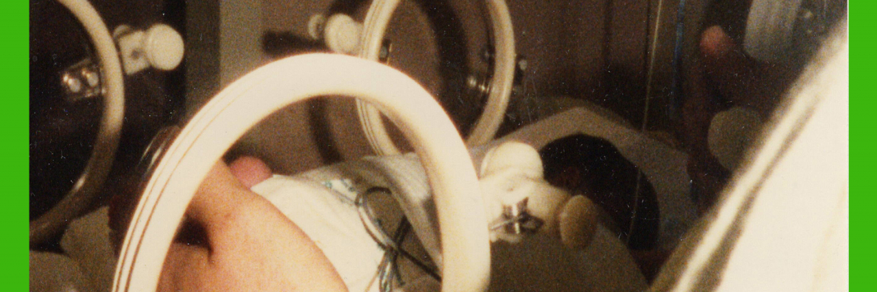 Why I Didn't Ask 'Why Me?' When My Daughter Was in the NICU Baby in NICU incubator.
