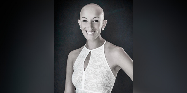 Lindsay, a woman who is bald due to alopecia.