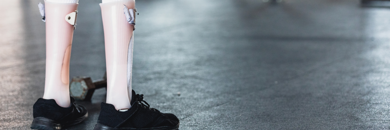 We Need to Embrace the Uncomfortable and Talk About Disability Closeup of a young woman's legs with leg braces.