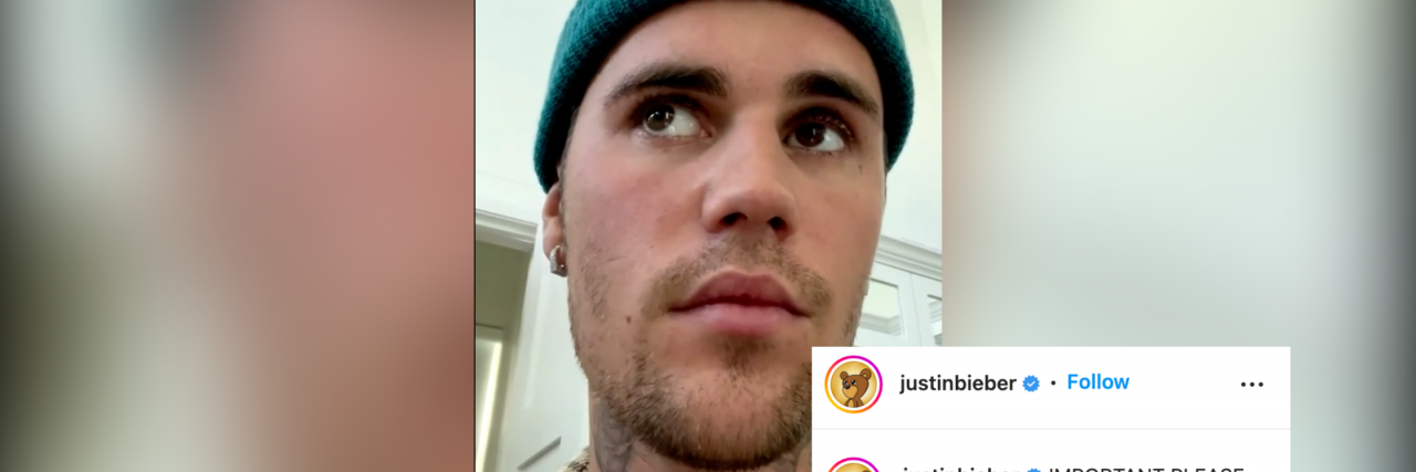 Justin Bieber Shows the Way We Talk About Facial Paralysis Matters A screenshot of Justin Bieber's Instagram where he's talking about having Ramsay Hunt Syndrome. He has a hat on with a plaid shirt. They don't match. His caption reads "Important, please watch. I love you guys please keep me in your prayers."