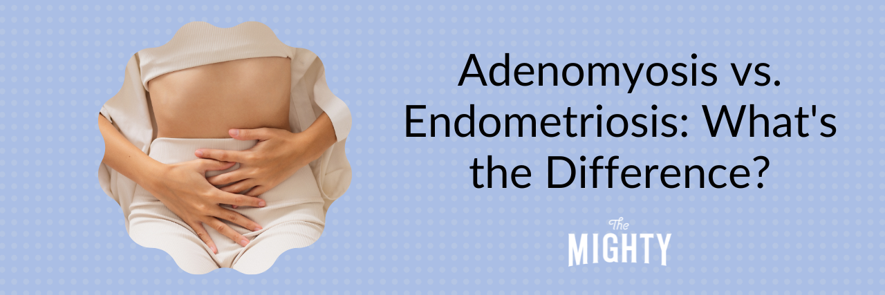Adenomyosis vs. Endometriosis: What's the Difference? Adenomyosis vs. endometriosis -- what's the difference?
