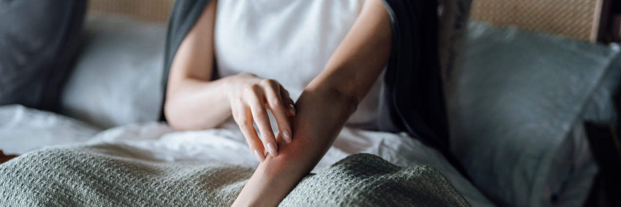 10 Tips for Cholestatic Pruritus in Alagille Syndrome