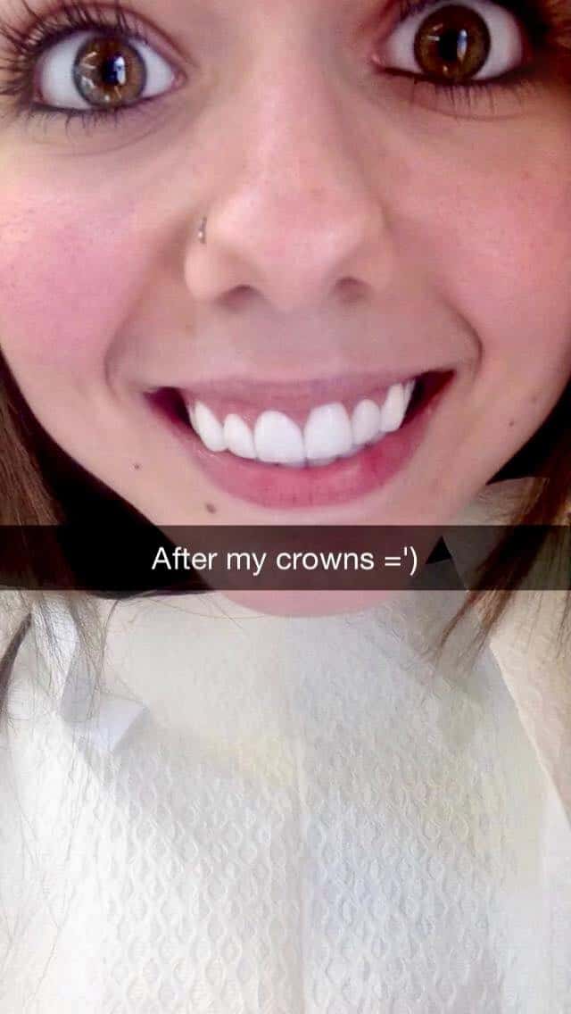 Kellyann's smiling face. Text beneath her says after my crowns