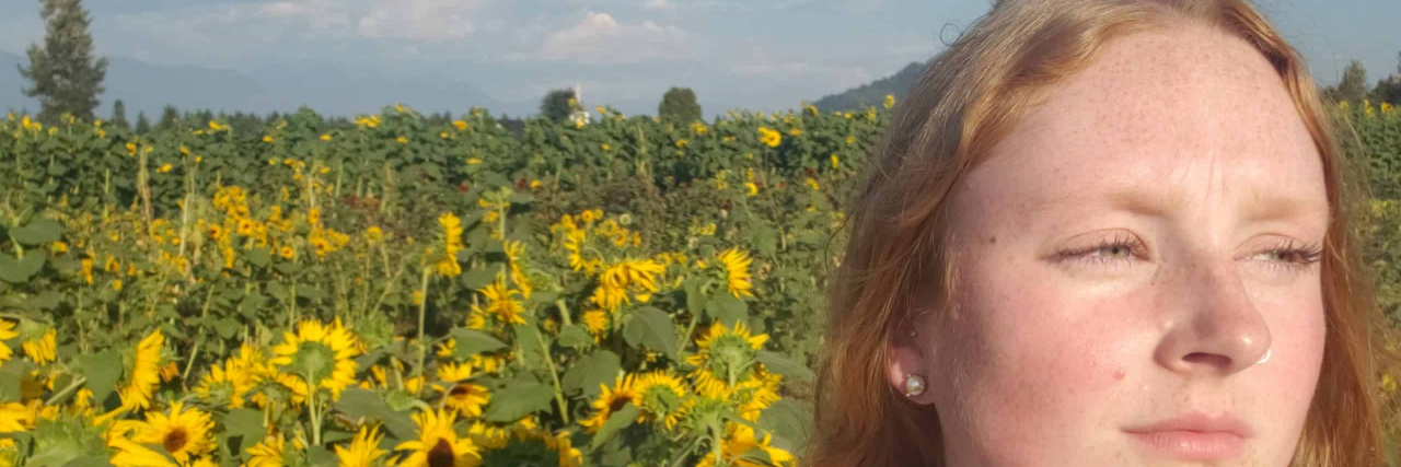 What Makes This Chronic Illness Milestone Worth Celebrating Contributor standing in front of field of sunflowers