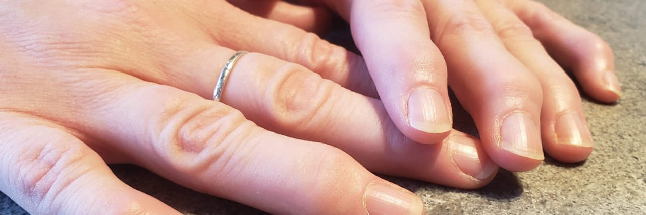 Pain Awareness Month: What I Need You to Know About Osteoarthritis Christina's hands