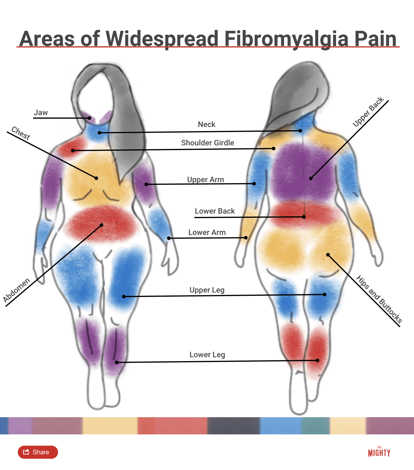Symptoms Of Fibromyalgia