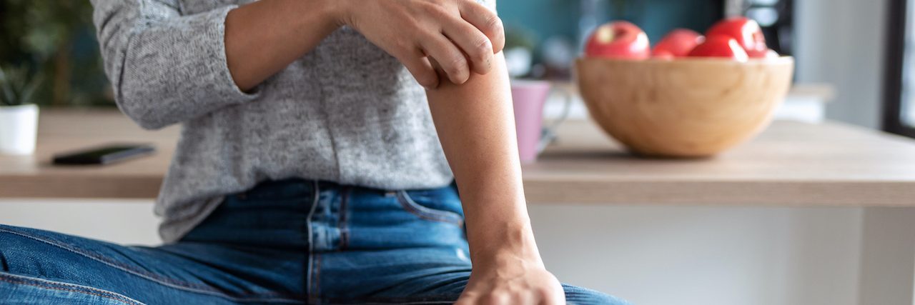What Is Guttate Psoriasis and How Do You Treat It? Close-up of woman scratching her arm while sitting on a stool in kitchen