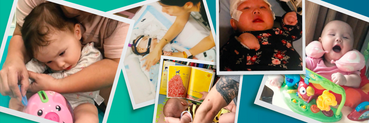 How Our Family Supports Our Child With AADC Deficiency