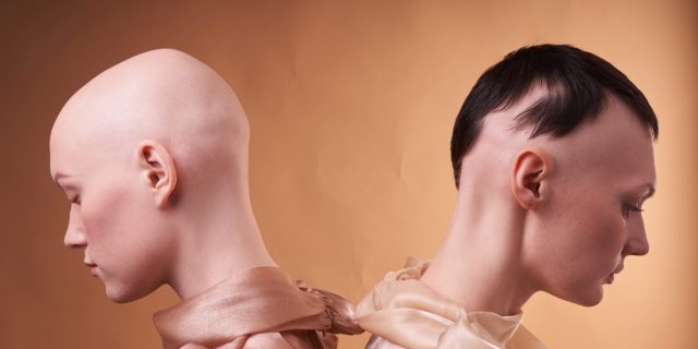Two women back to back, connected by the same problem, different stages of alopecia. Hair loss problem, young women with baldness and closed eyes on beige background. The concept of human support, female power, social inequality, hereditary disease, connection, mental health, acceptance, body positivity, diversity and inclusion.