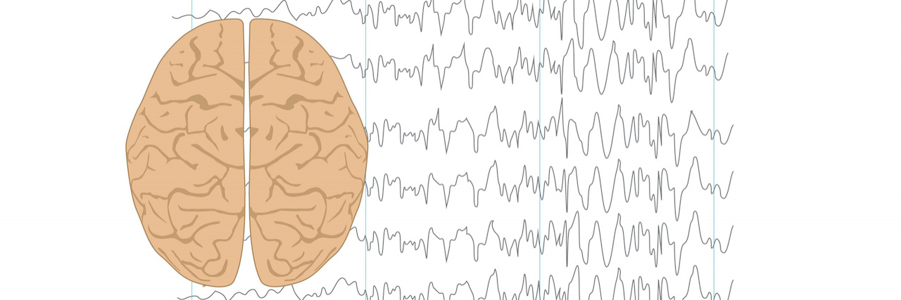 What Are the 12 Types of Seizures Illustration of human brain and brain waves