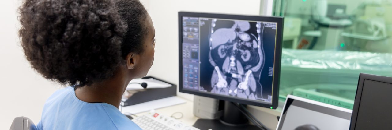 Primary Biliary Cholangitis: Treatment Approaches and Options