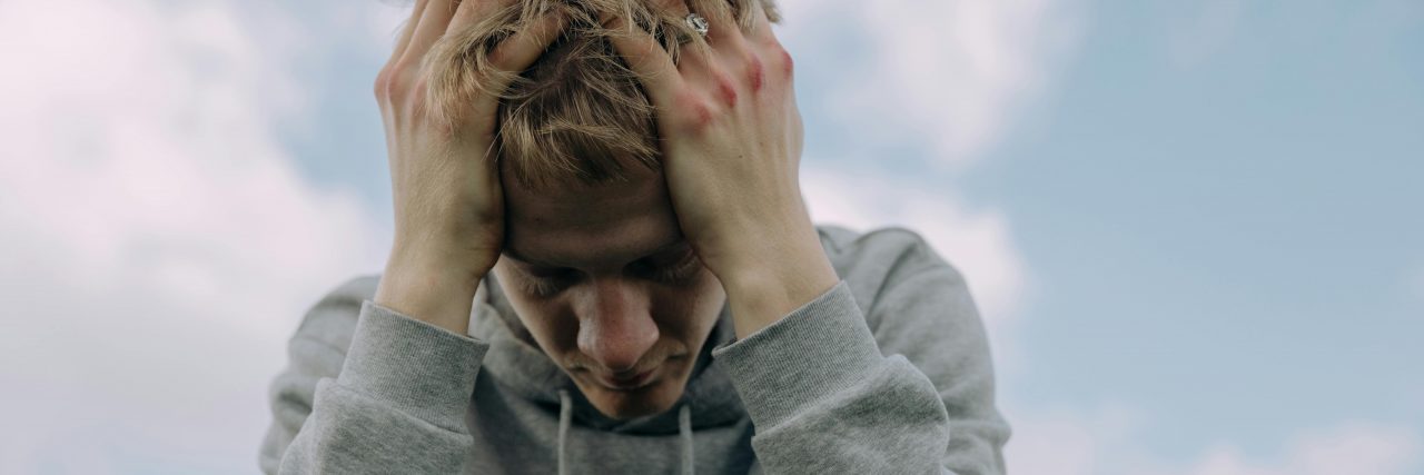 man with scalp pain