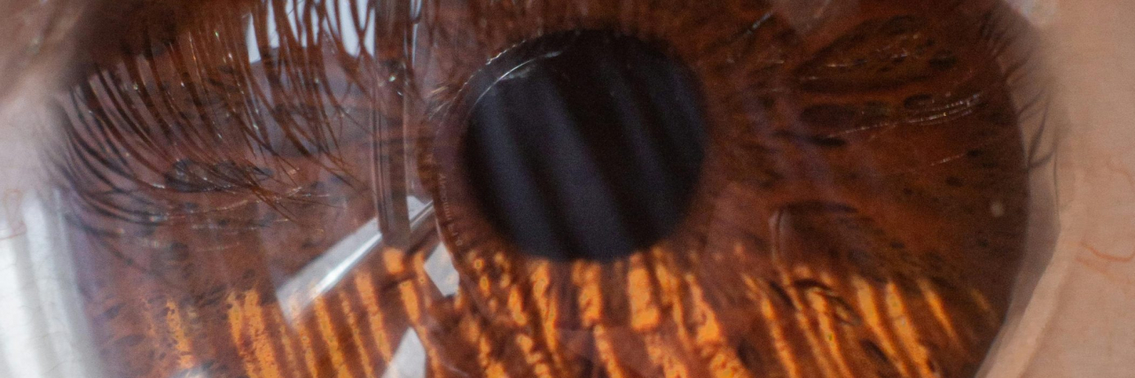 What Is Polyopia? close up of a brown eye