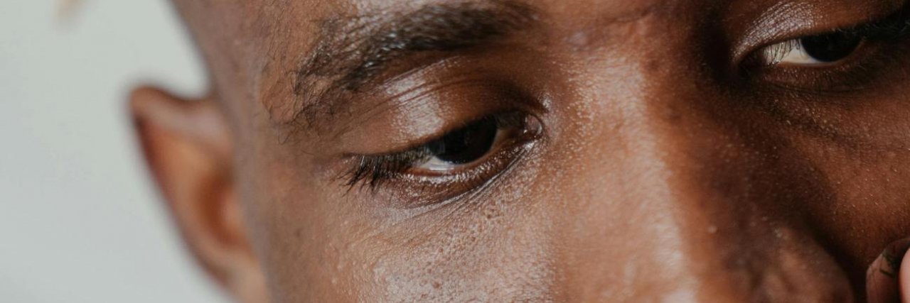 Migraine and Muscle Twitches close up of man's face