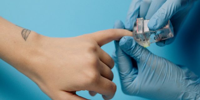 Doctor inspecting fingernails