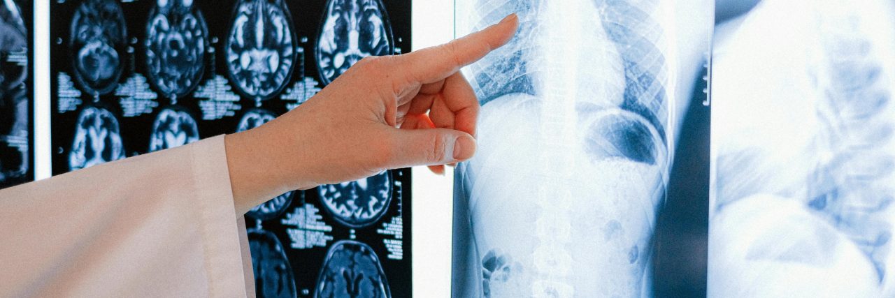 What Is Situs Inversus? chest mri