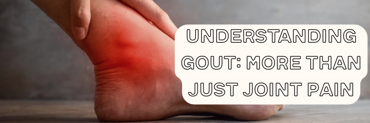 Understanding Gout: More Than Just Joint Pain