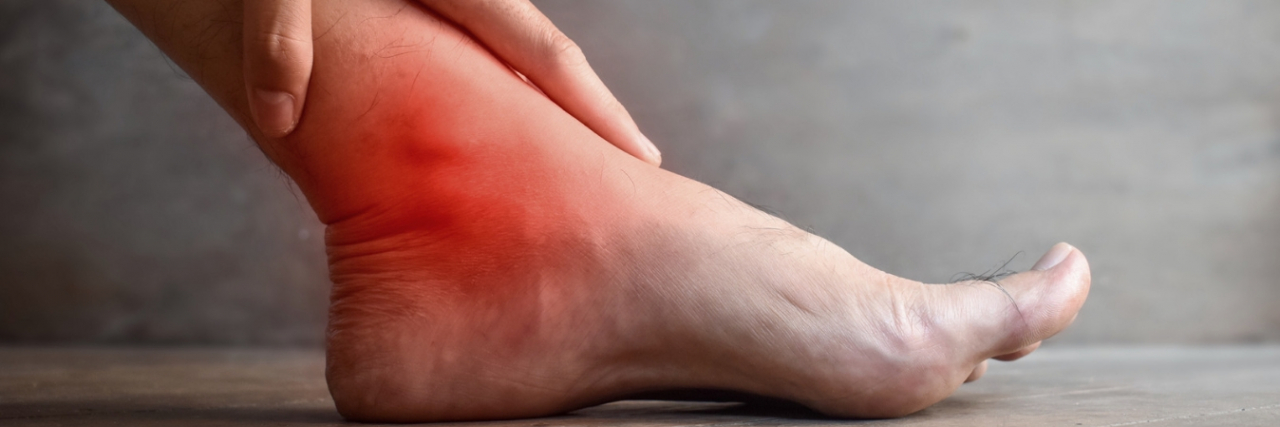 Understanding Gout: More Than Just Joint Pain