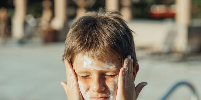 Types of Sun Allergies: Understanding Reactions to Sunlight (And Why They’re More Common Than You Think) boy with sunscreen on