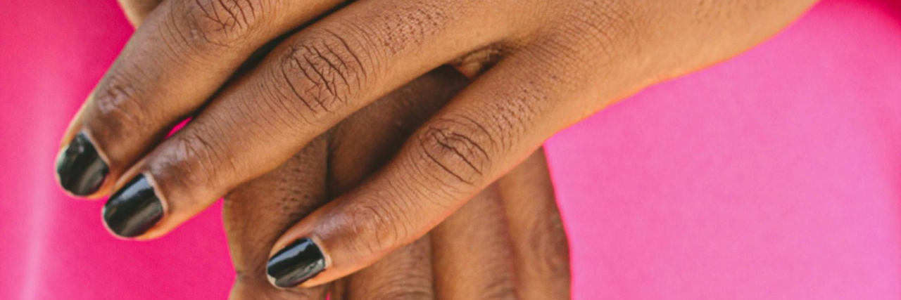 What Are 'Migraine Hands'? hands with black painted nails