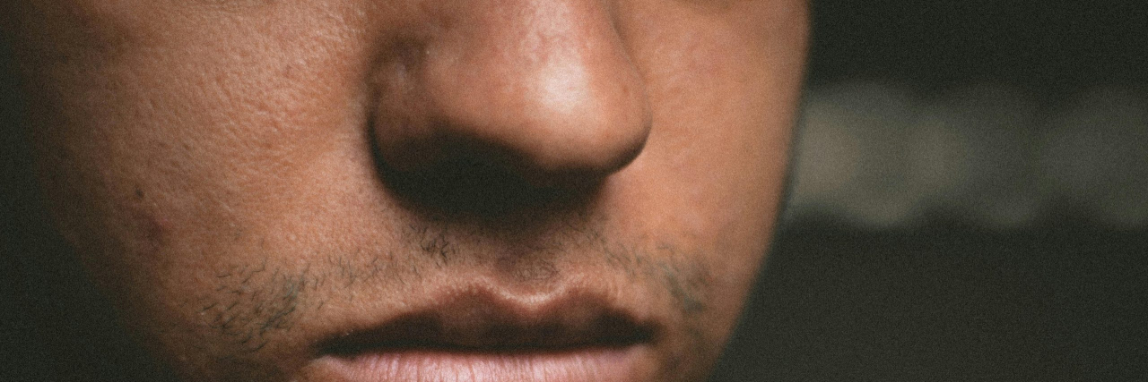 Osmophobia Symptoms Embarrassing close up of nose