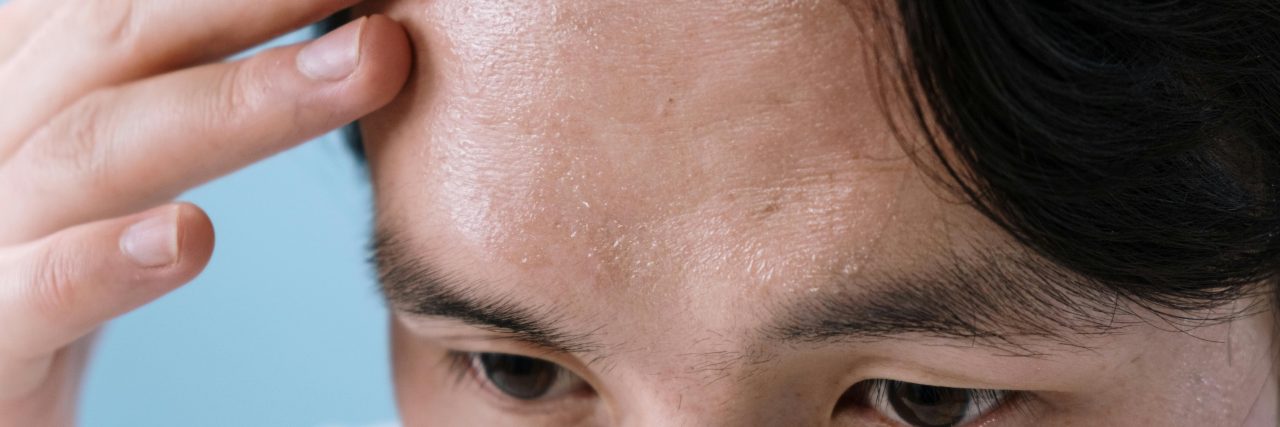 Harlequin Syndrome Migraine Overlap person with headache after a workout