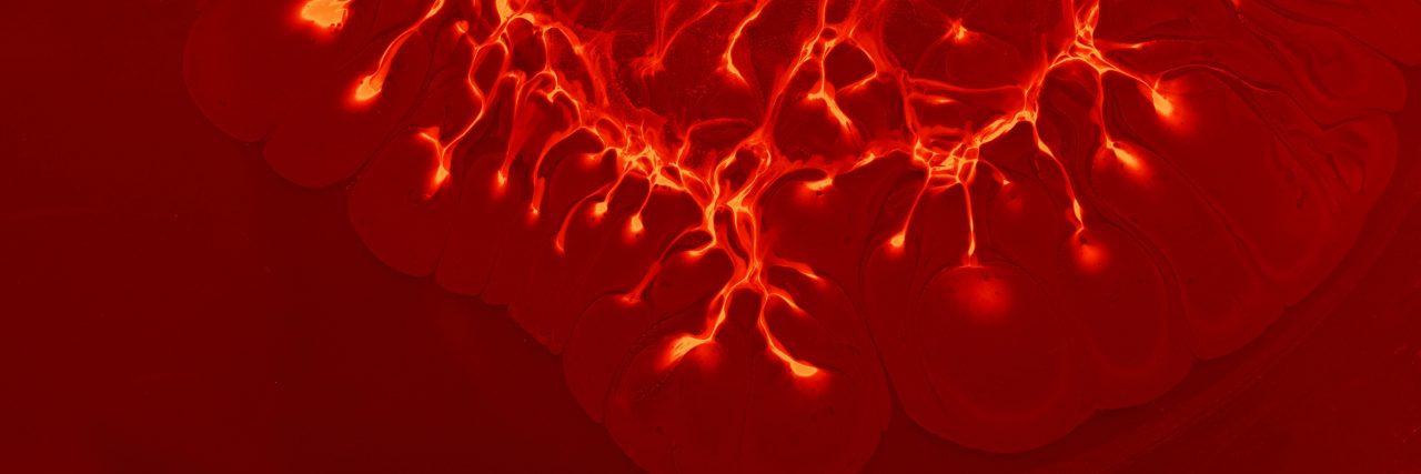 screening image of inflammation