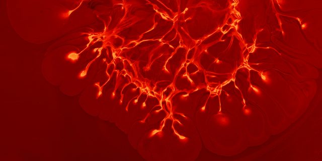 screening image of inflammation